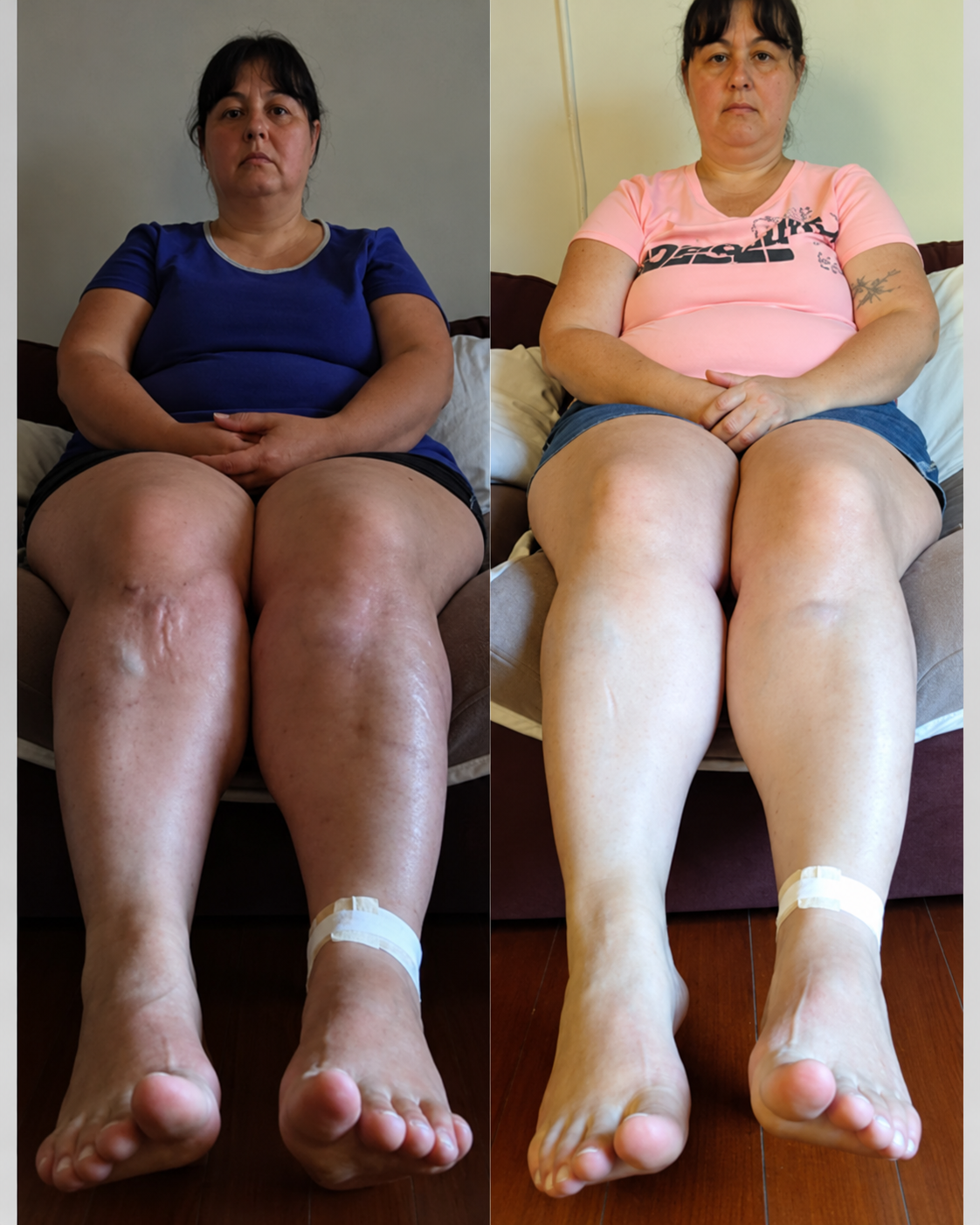 Pernas e tornozelos em comparação